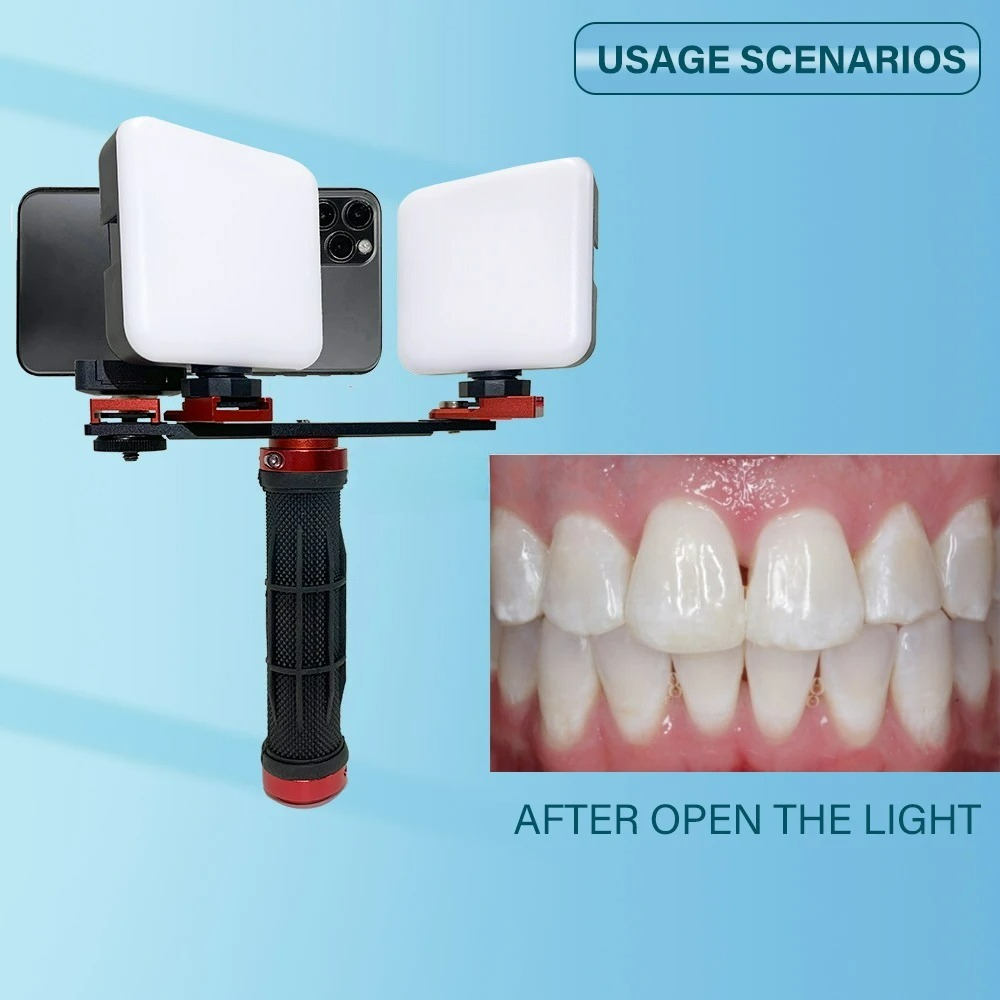 歯科写真撮影ライトフォン、Bluetooth搭載、歯科医師用 - Photography Lighting Accessories のレビューと価格
